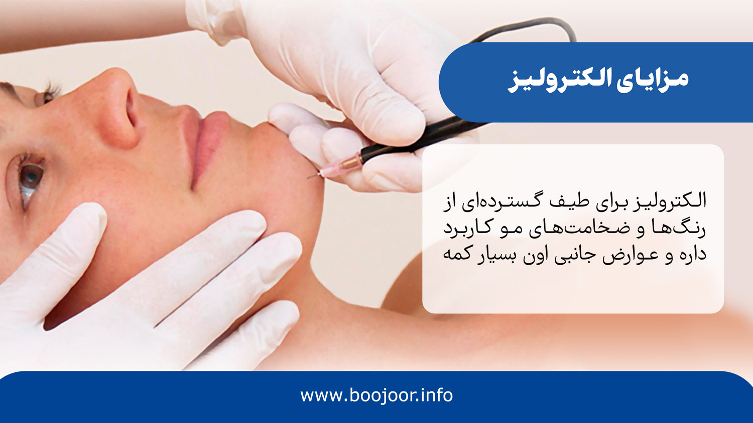 مزایای الکترولیز
