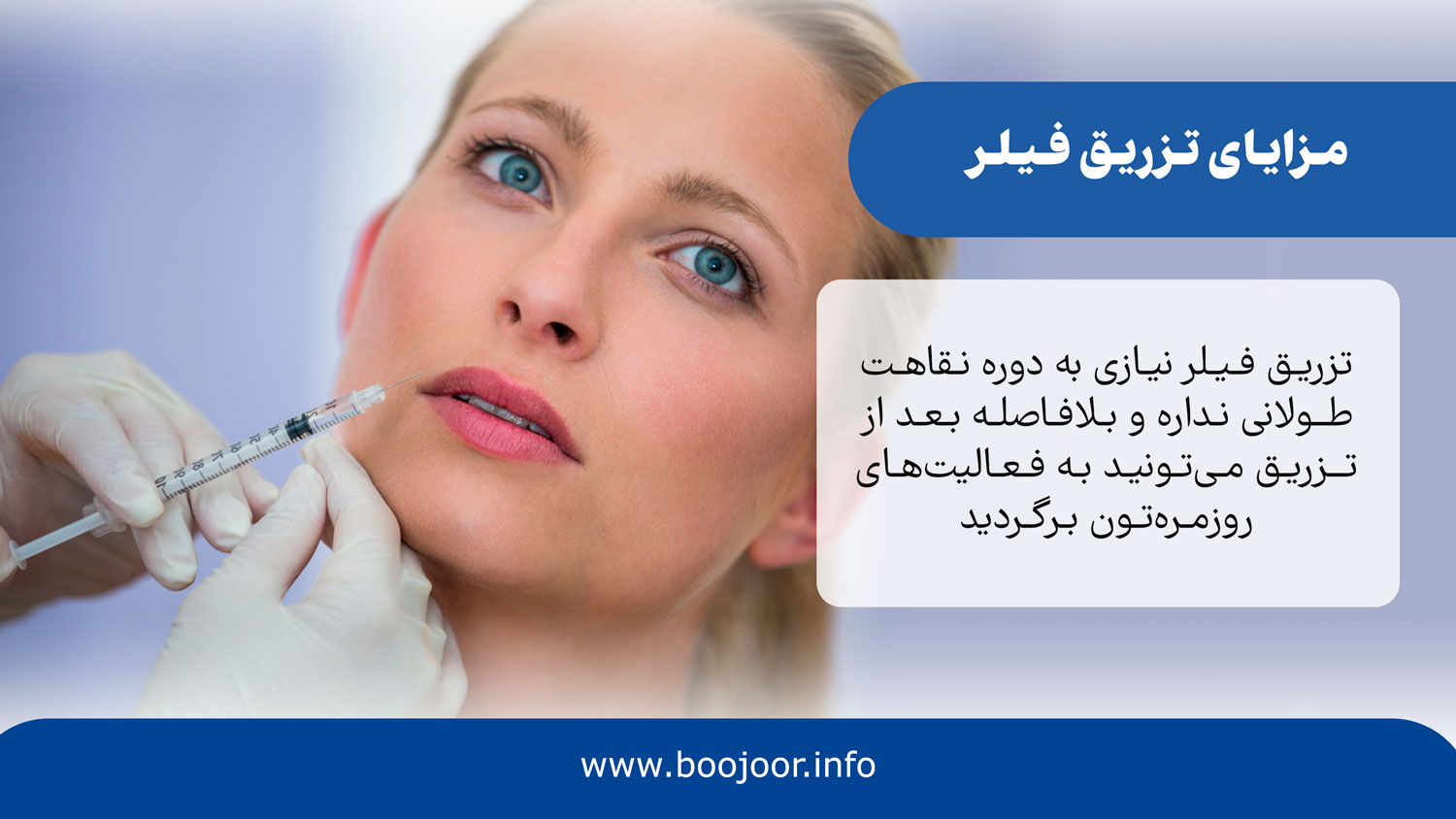 مزایای تزریق فیلر در شیراز