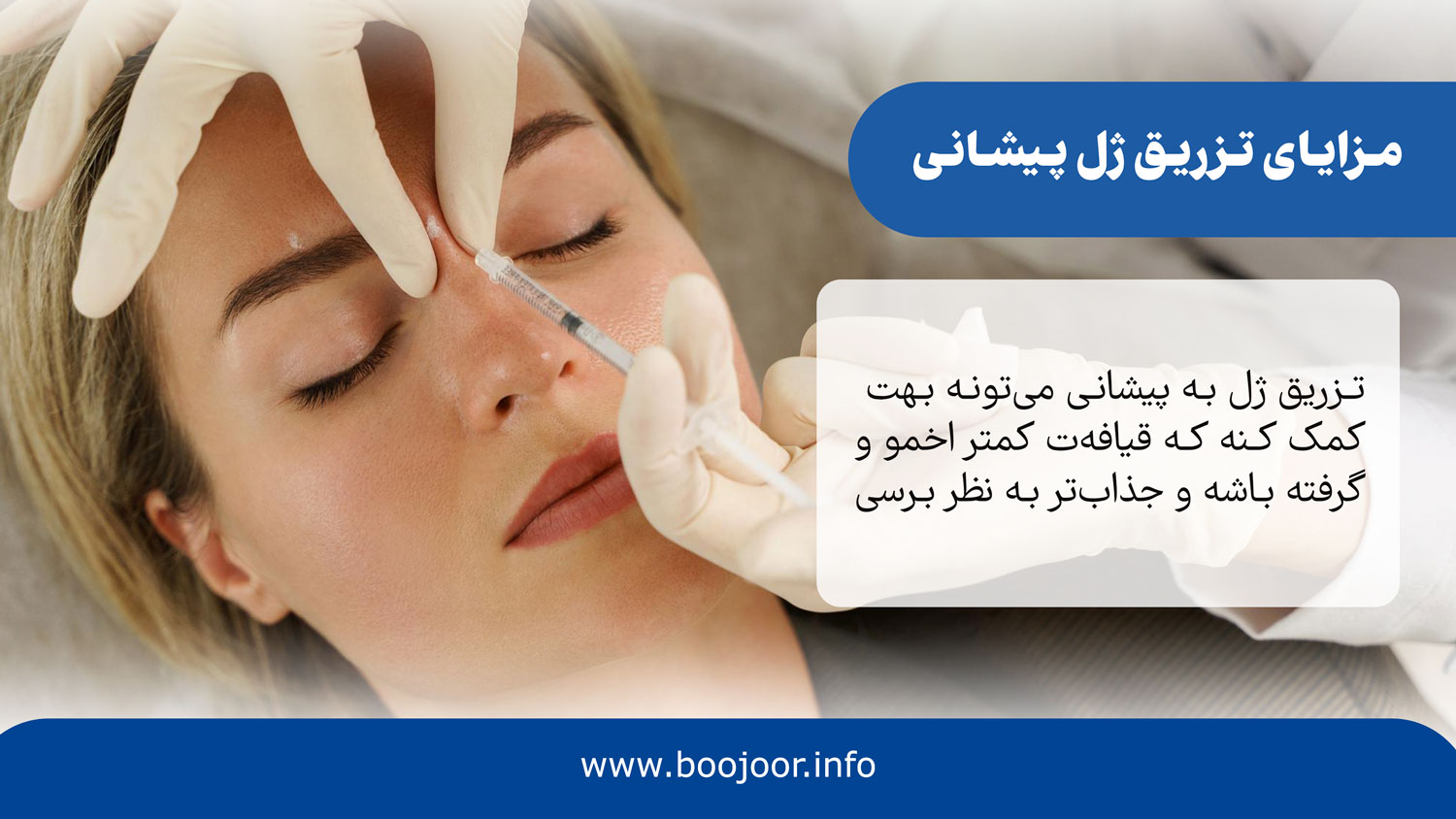 مزایای تزریق ژل به پیشانی