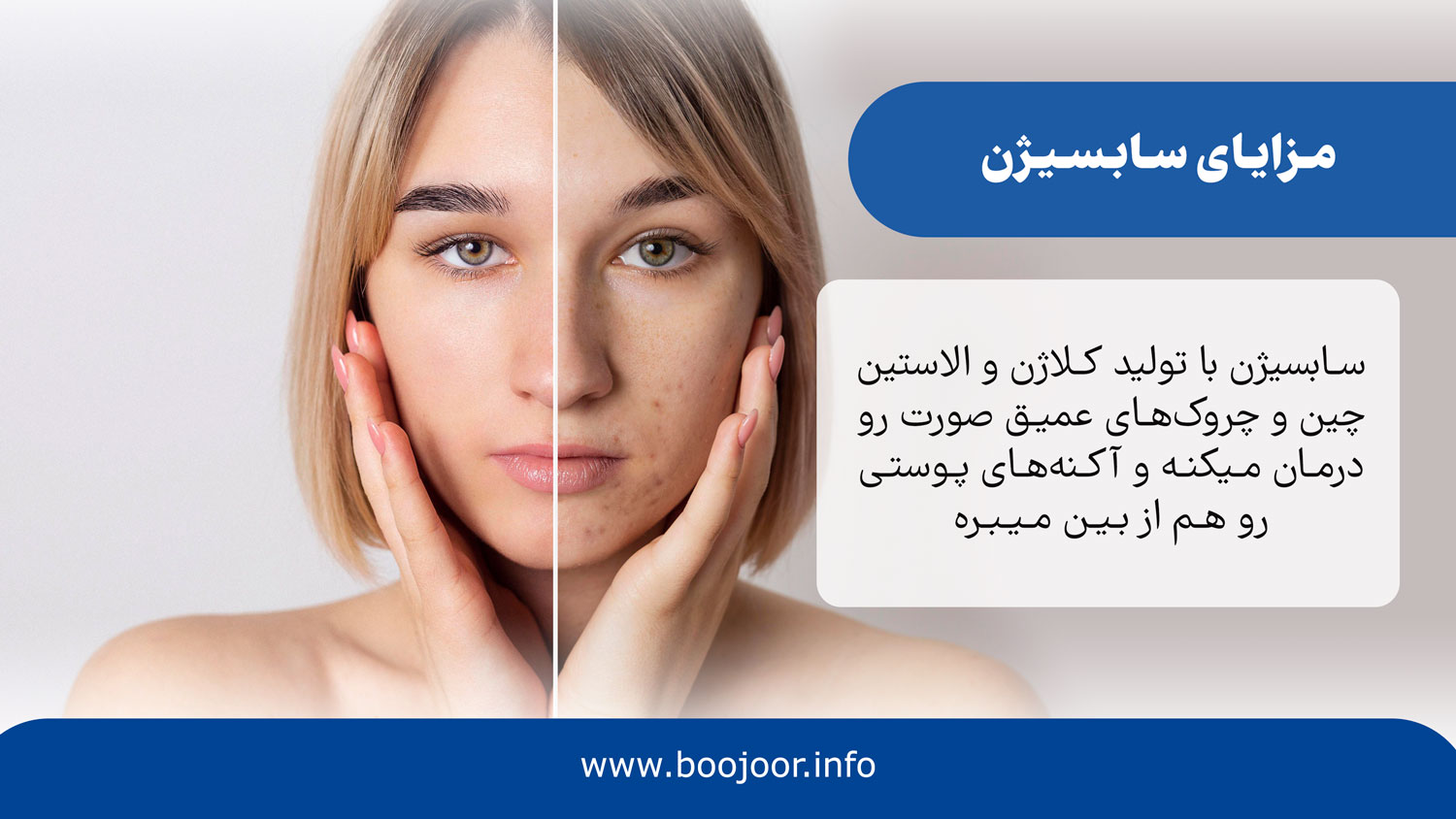 مزایای سابسیژن در شیراز