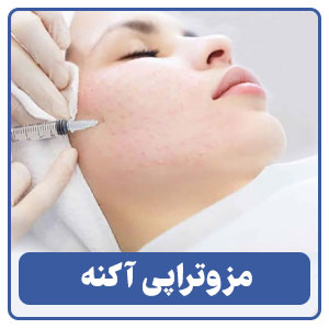مزوتراپی برای درمان آکنه در شیراز