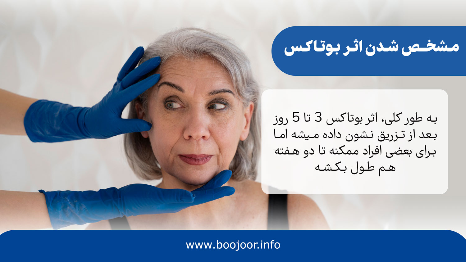 مشخص شدن اثر بوتاکس