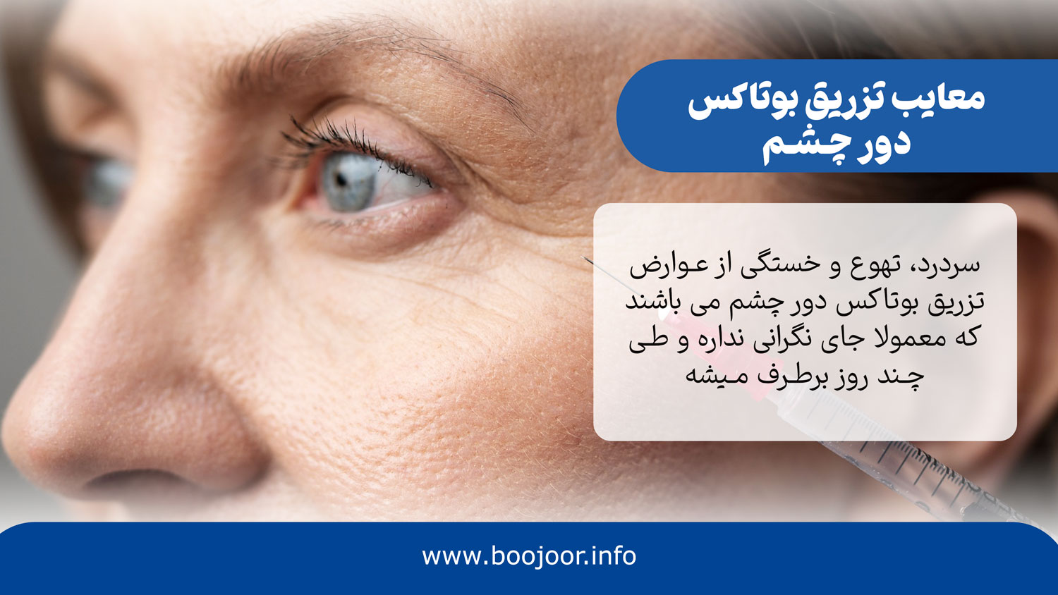 معایب تزریق بوتاکس دور چشم