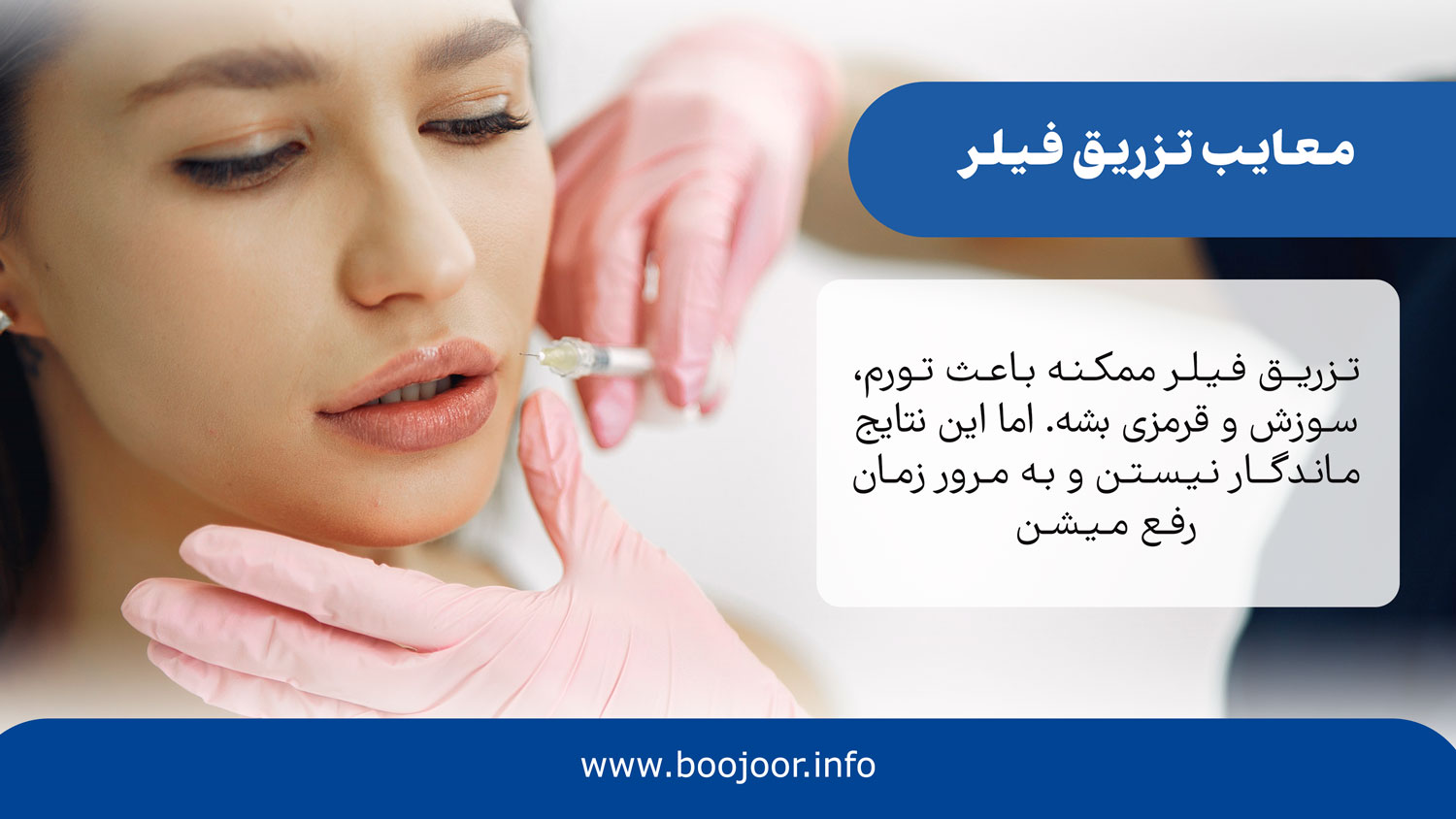 معایب تزریق فیلر