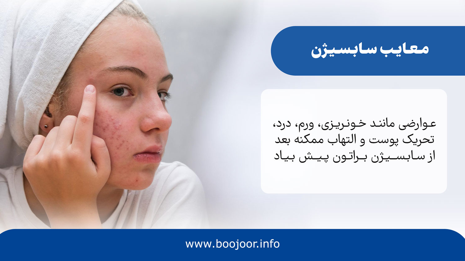 معایب سابسیژن در شیراز
