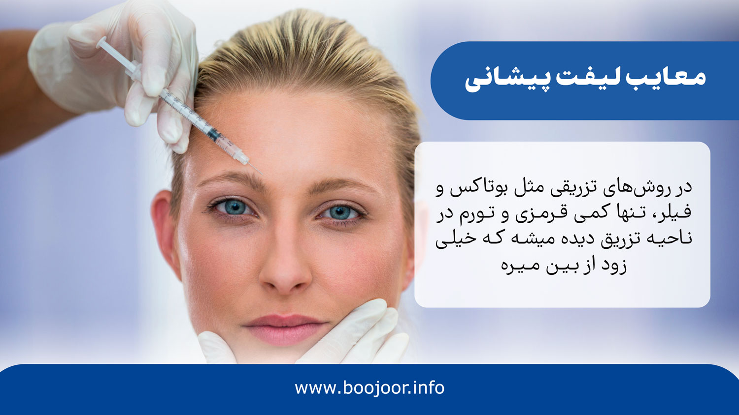 معایب لیفت پیشانی