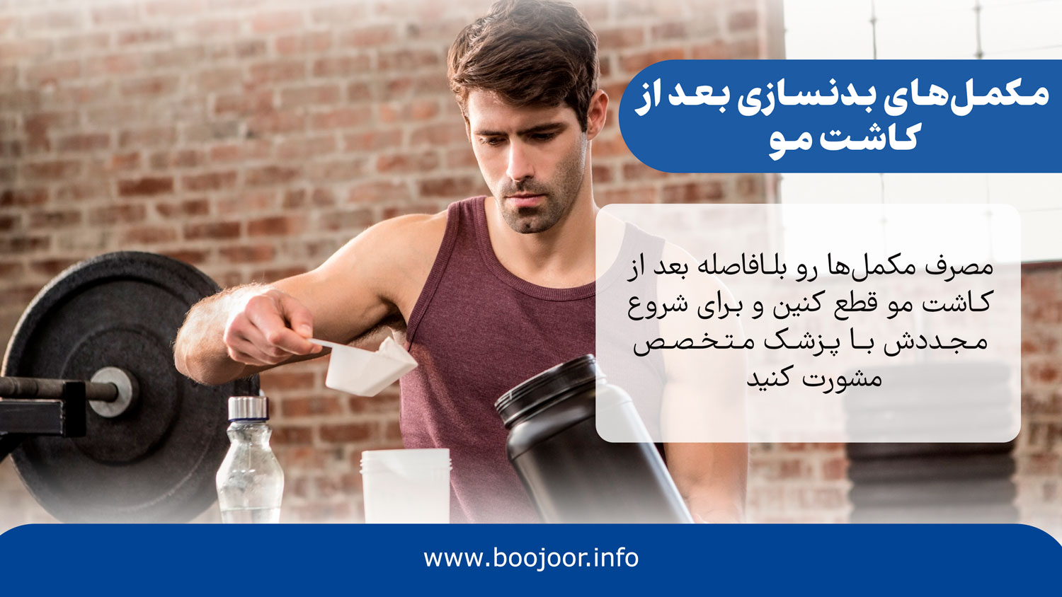 مکمل بدنسازی بعد از کاشت مو