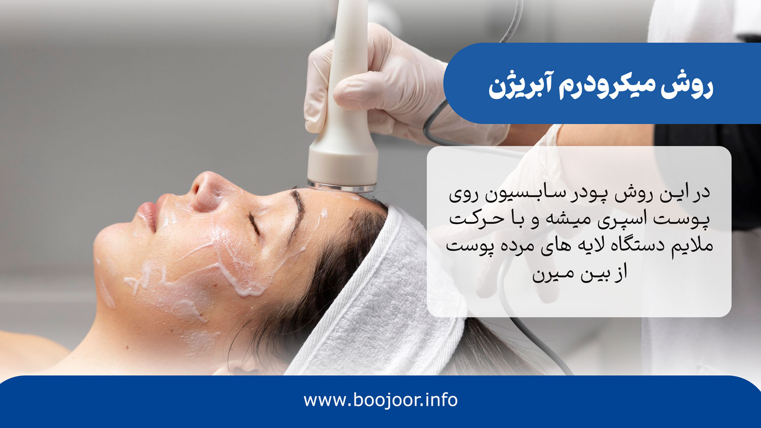میکرودرم آبریژن