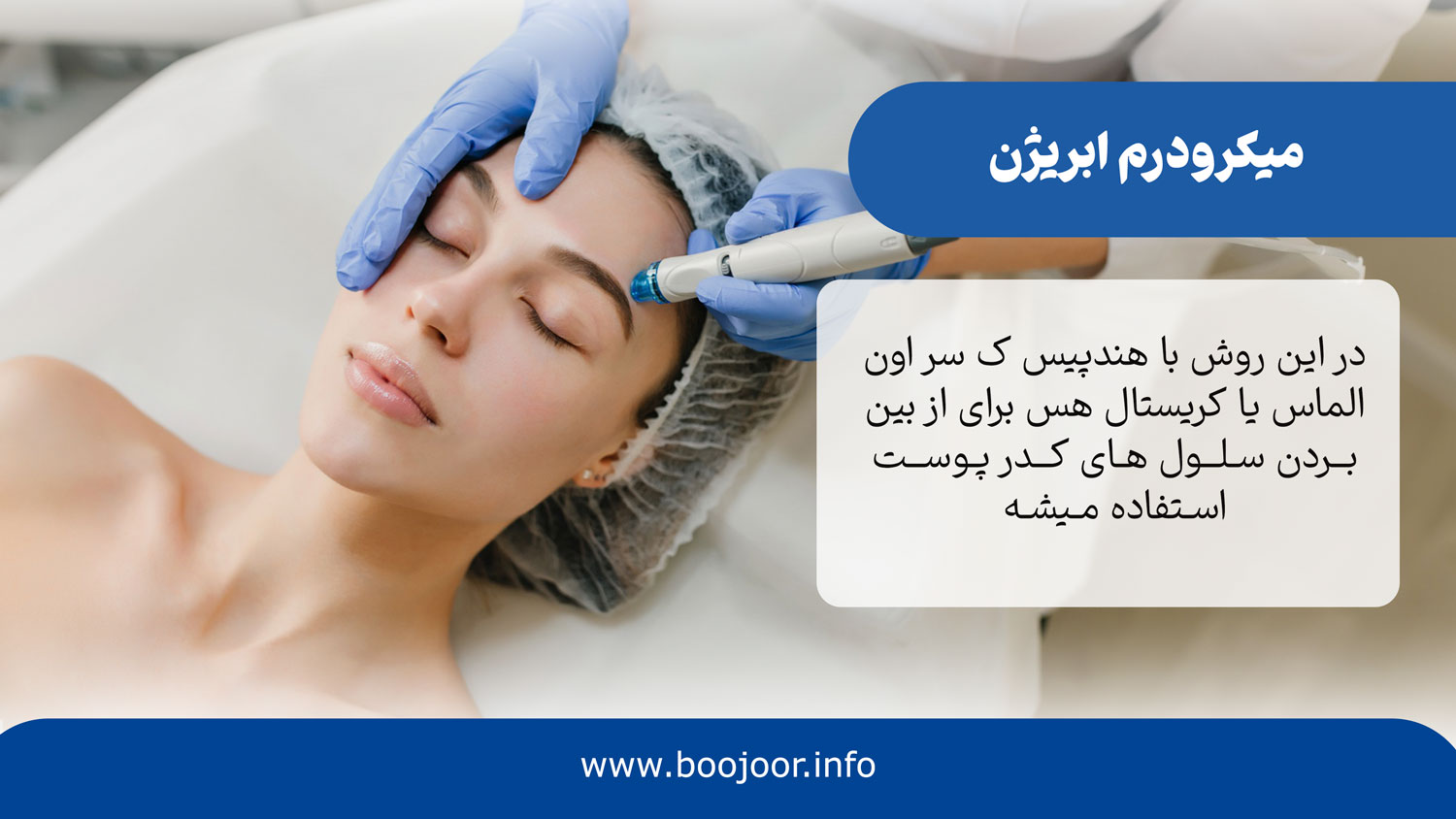 میکرودرم آبریژن