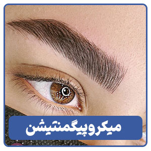 میکروپیگمنتیشن