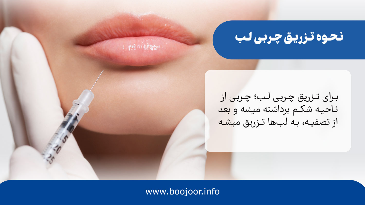 نحوه تزریق چربی لب