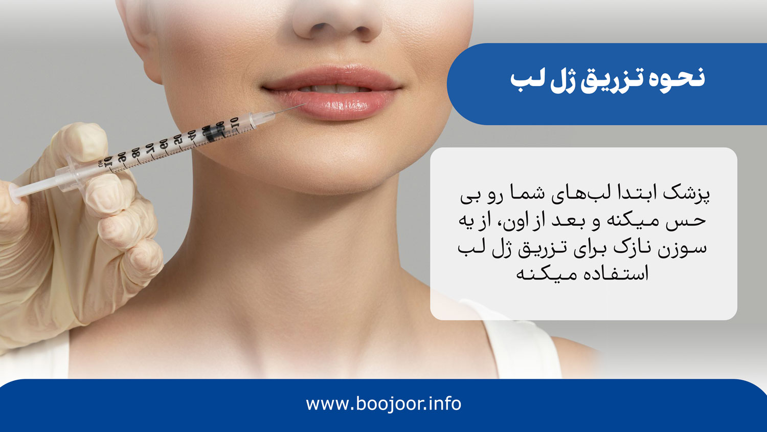 نحوه تزریق ژل لب