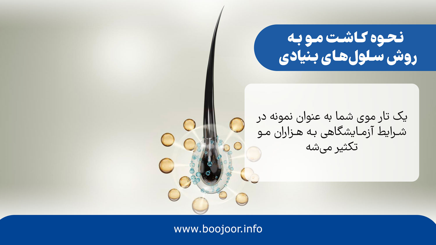 نحوه کاشت مو به روش سلول های بنیادی