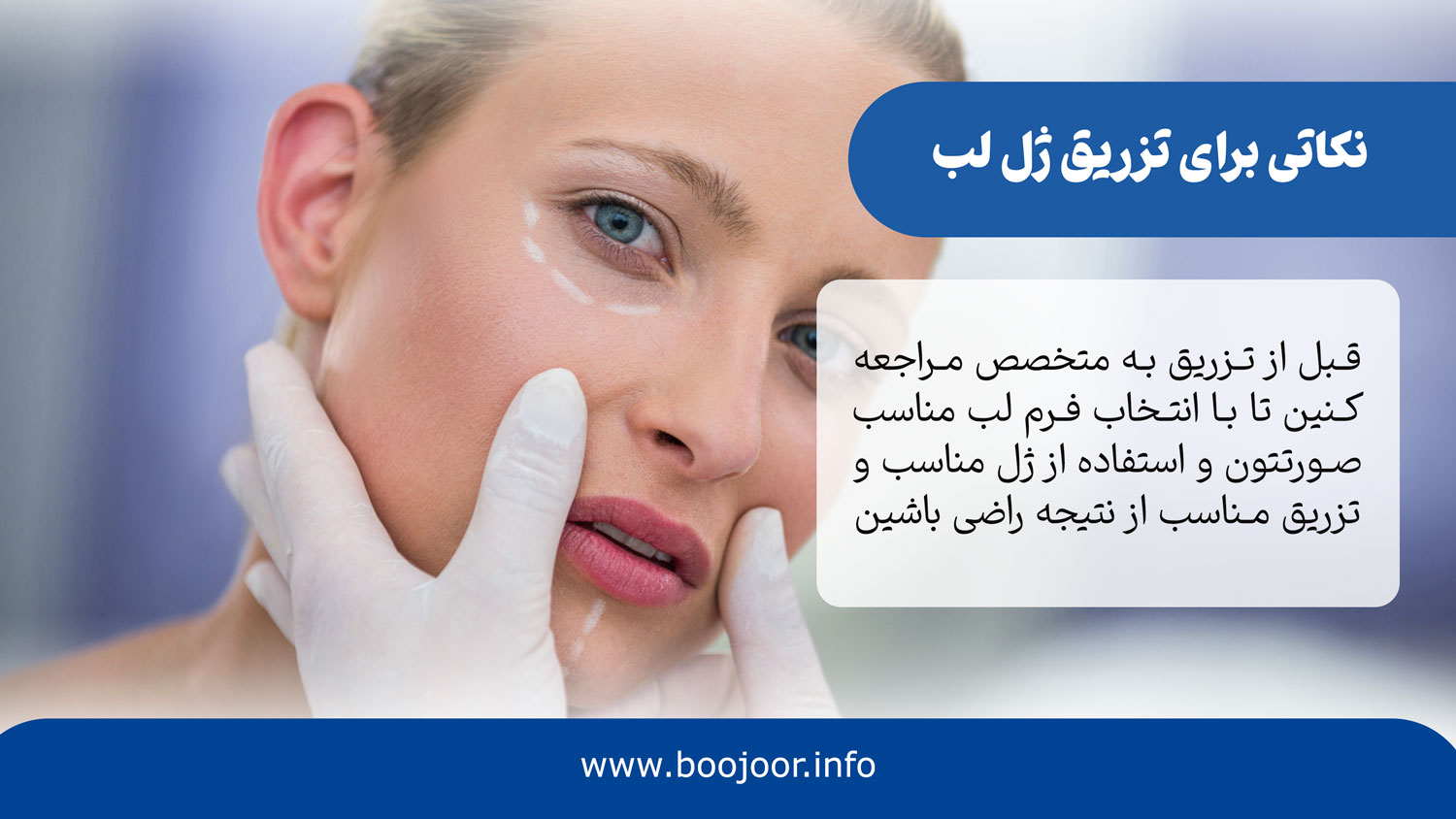 نکات تزریق ژل لب