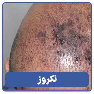 نکروز
