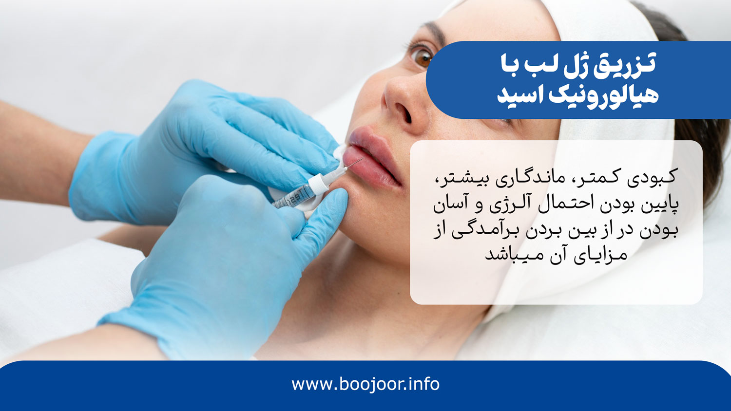مزایای ژل لب