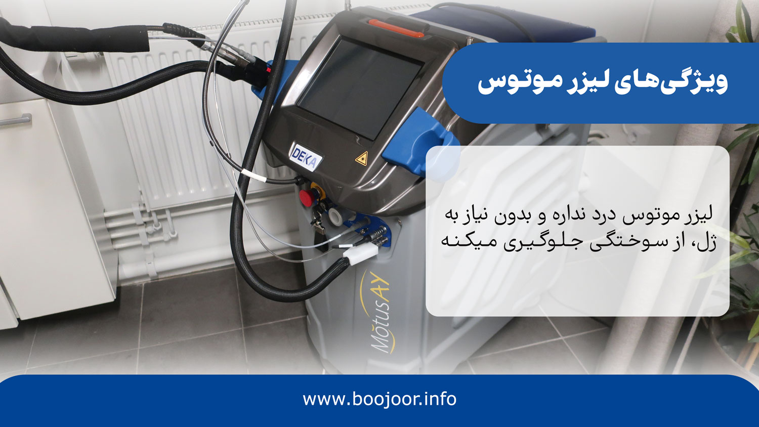 ویژگی های لیزر موتوس