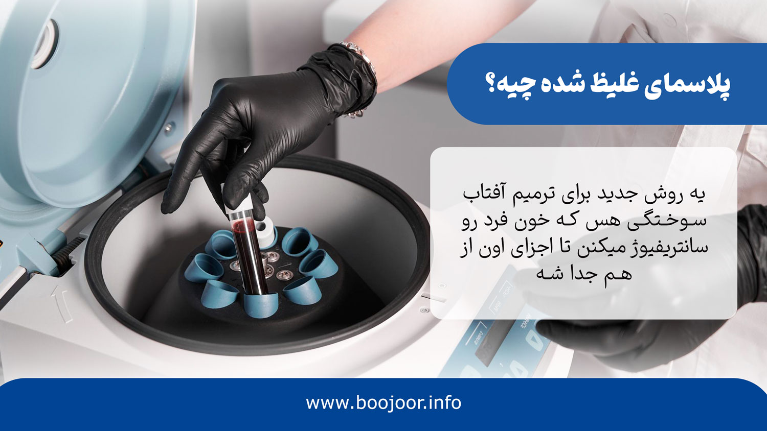 پلاسمای غلیظ شده چیه
