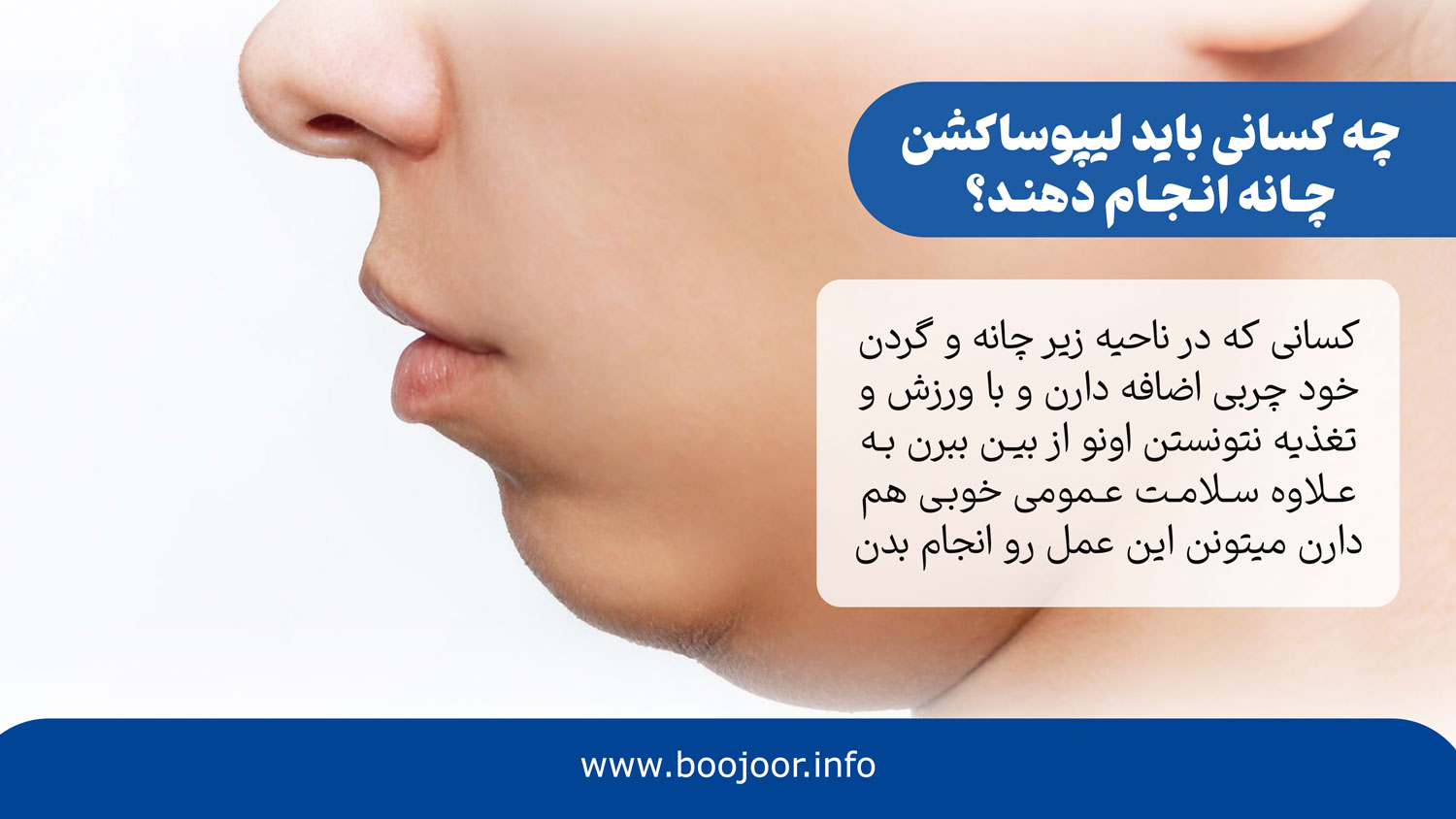چه کسانی باید لیپوساکشن چانه انجام دهند
