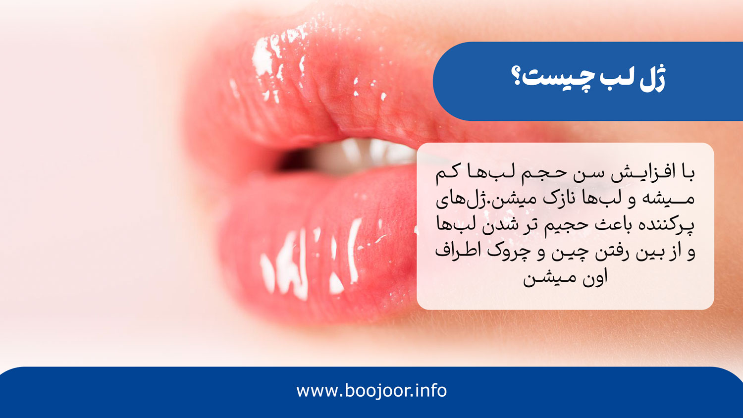 ژل لب چیست