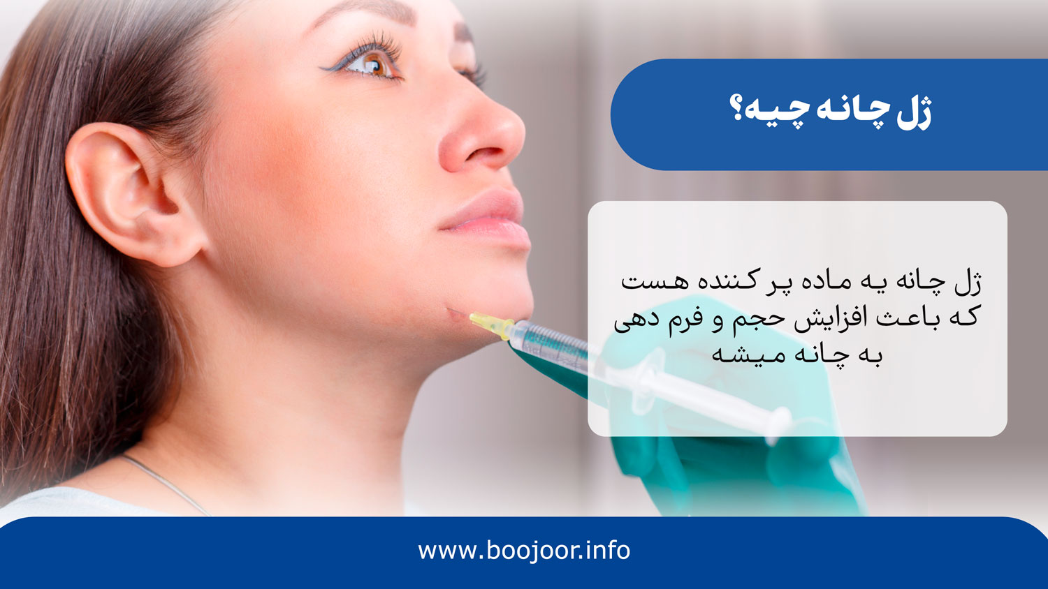 ژل چانه چیه؟