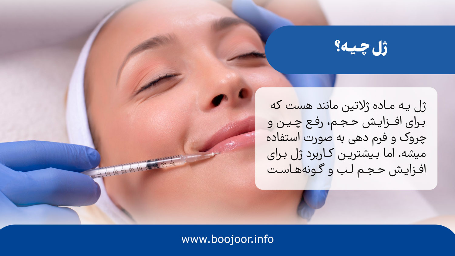 ژل چیه؟