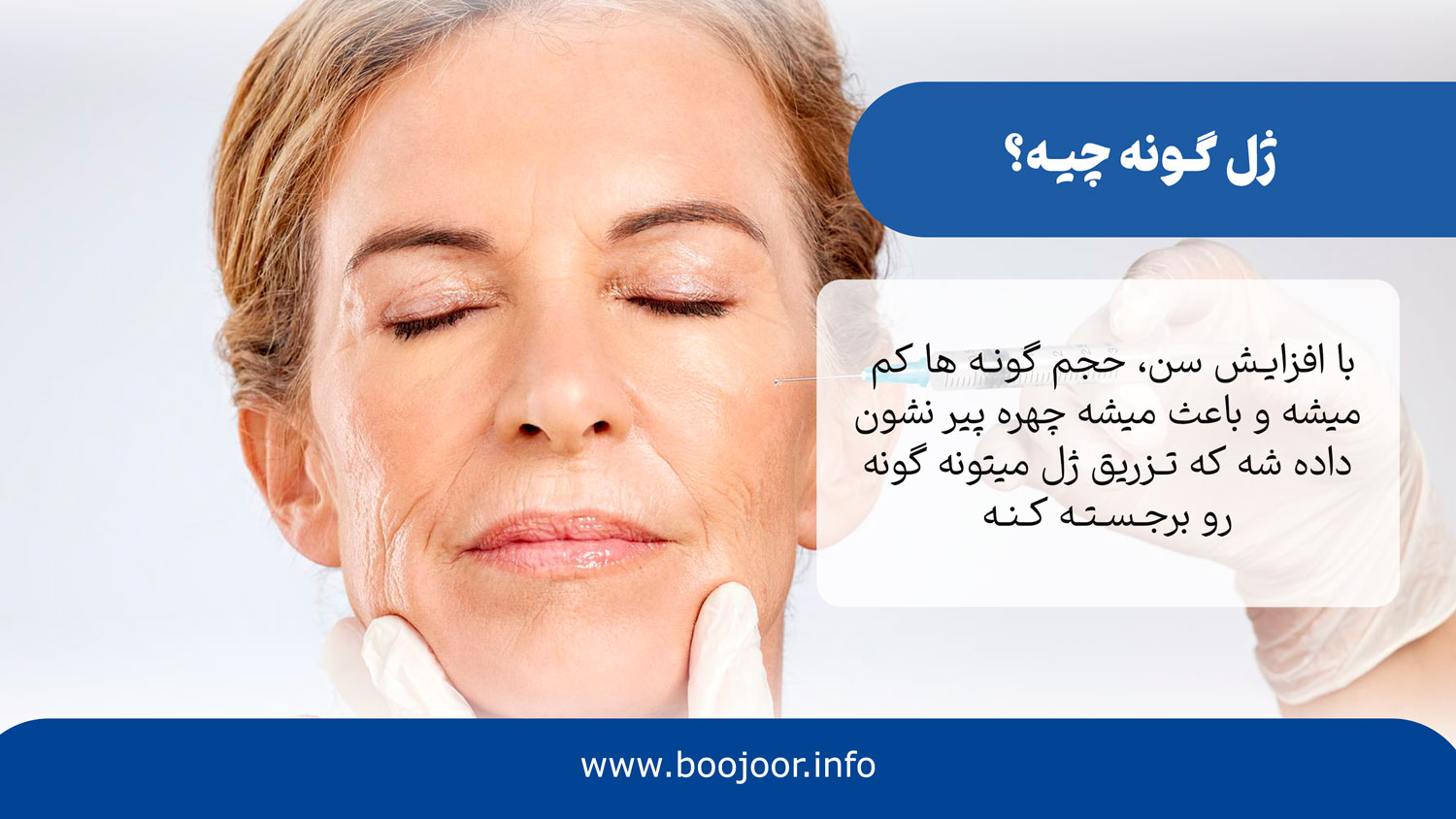 ژل گونه چیست