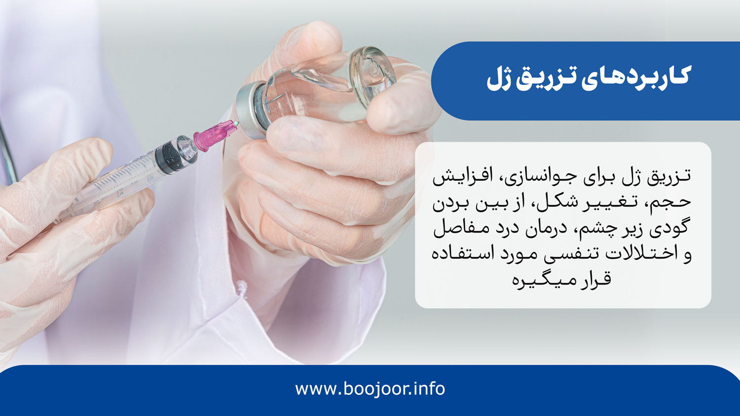 کاربردهای تزریق ژل در شیراز