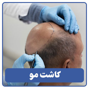 کاشت مو، ابرو و ریش