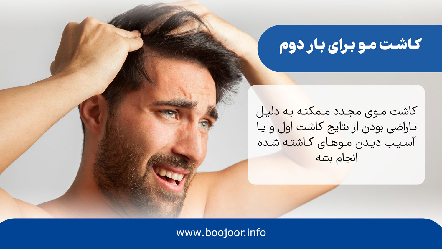 کاشت مو برای بار دوم