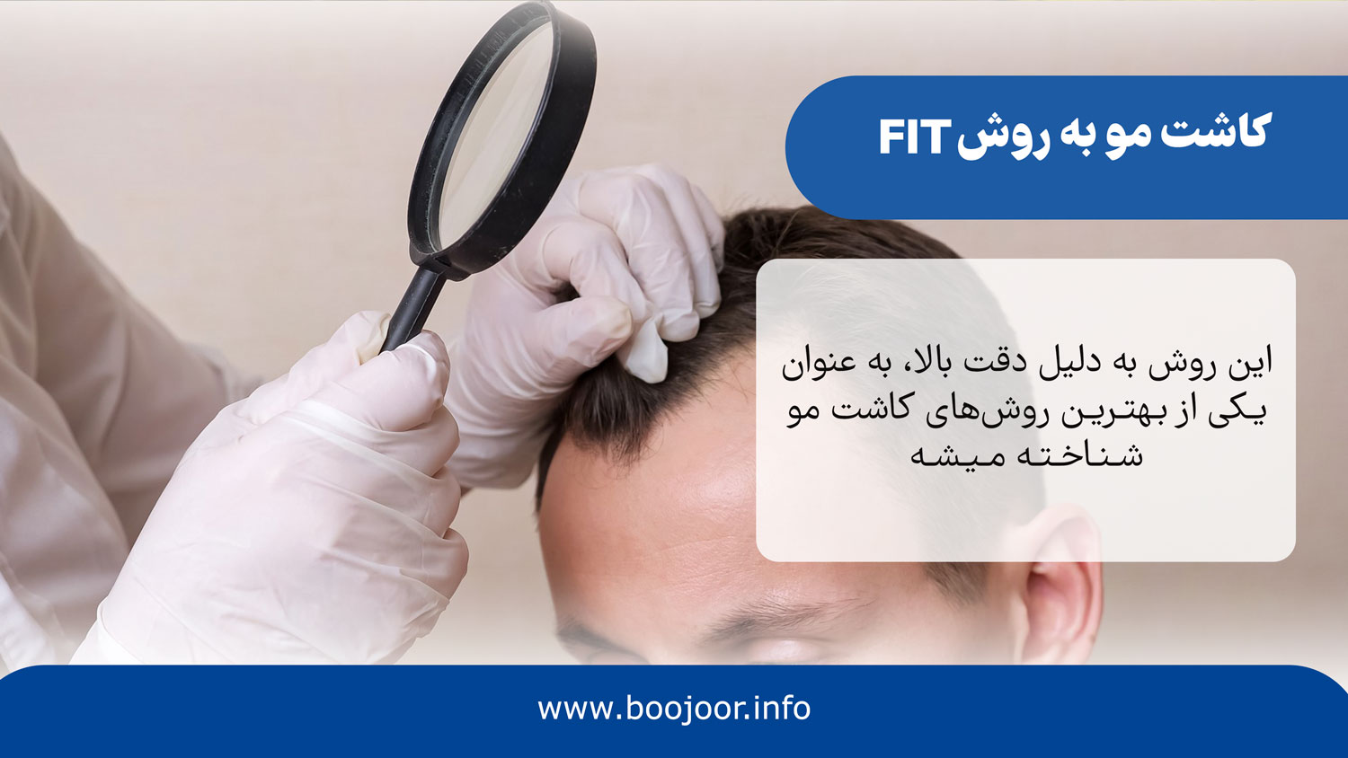کاشت مو به روش fit