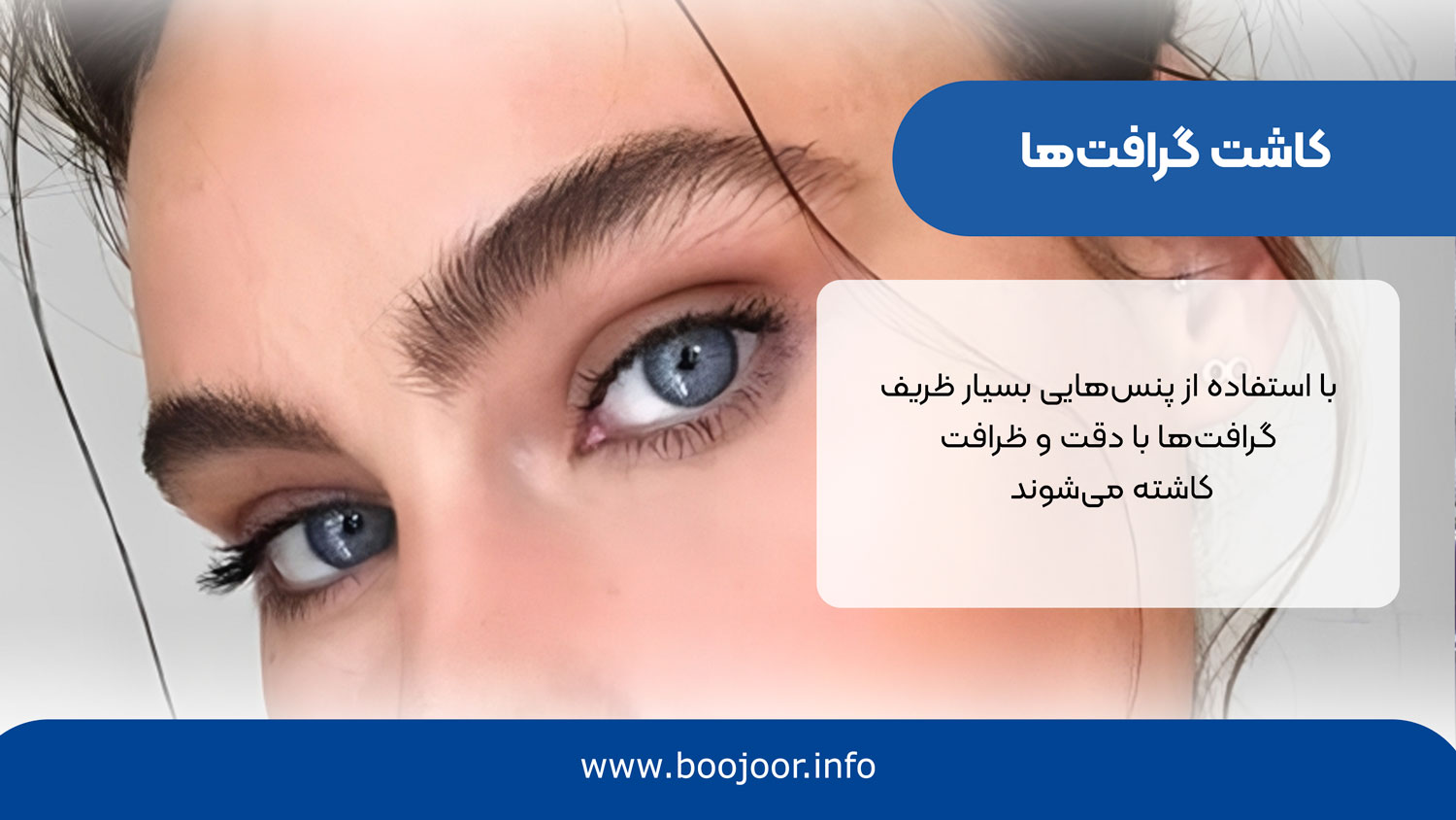 کاشت گرافت ها