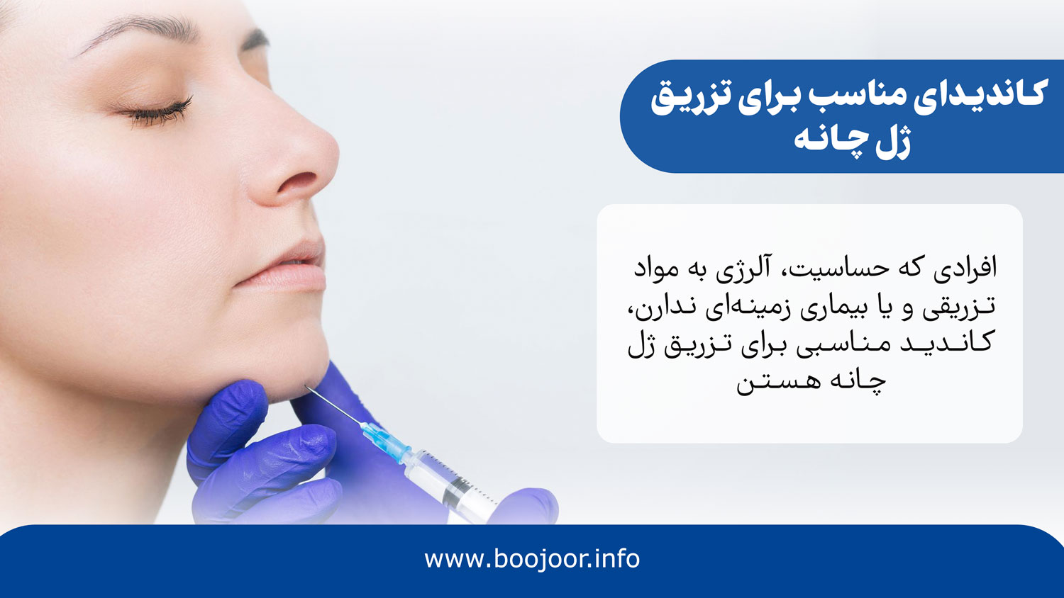 کاندیدای مناسب برای تزریق ژل چانه