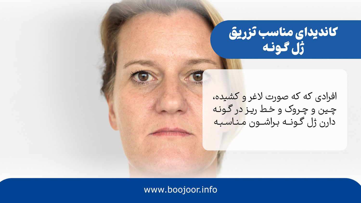 کاندیدای مناسب ژل گونه