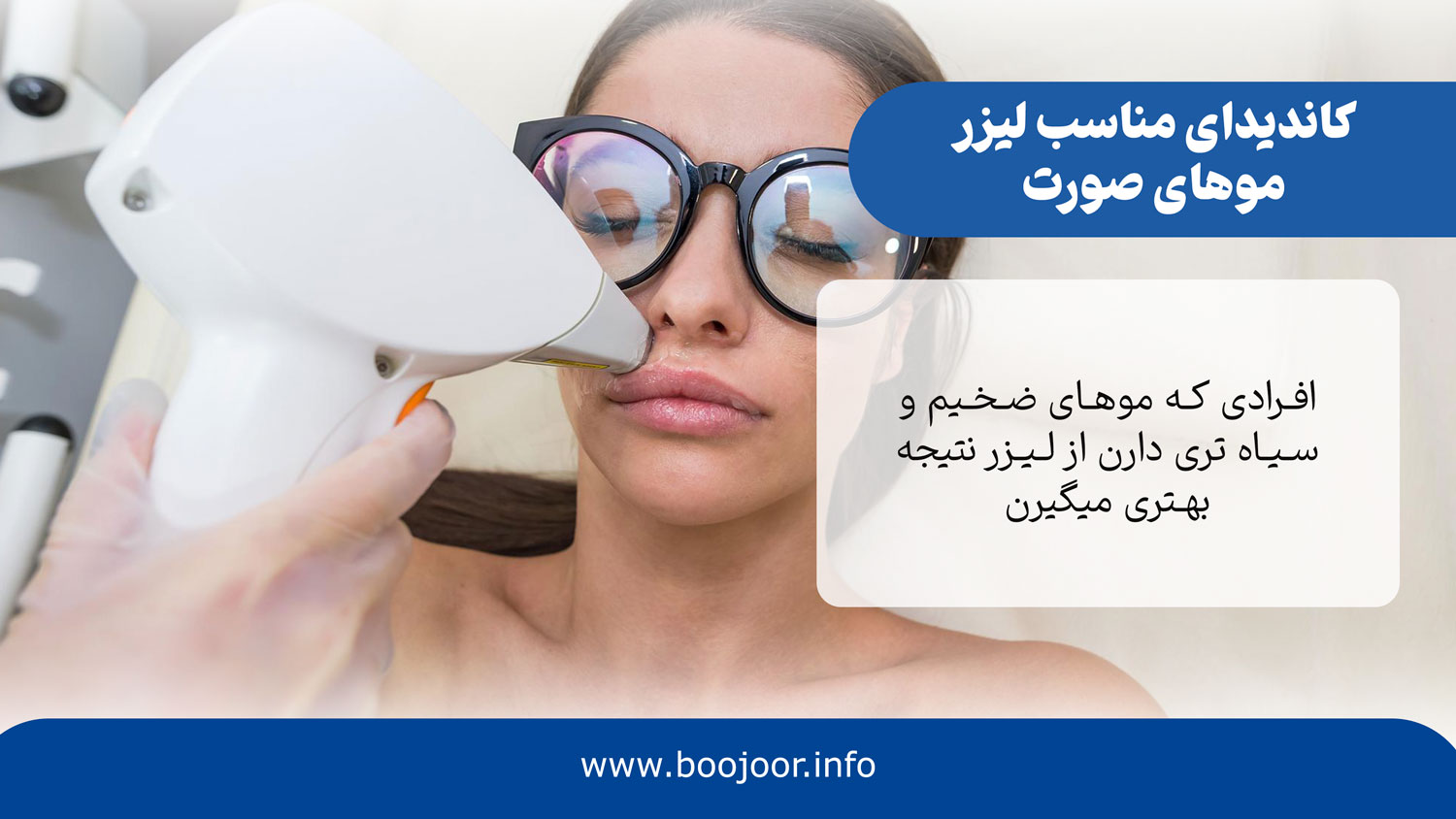 کاندیدای مناسب لیزر صورت