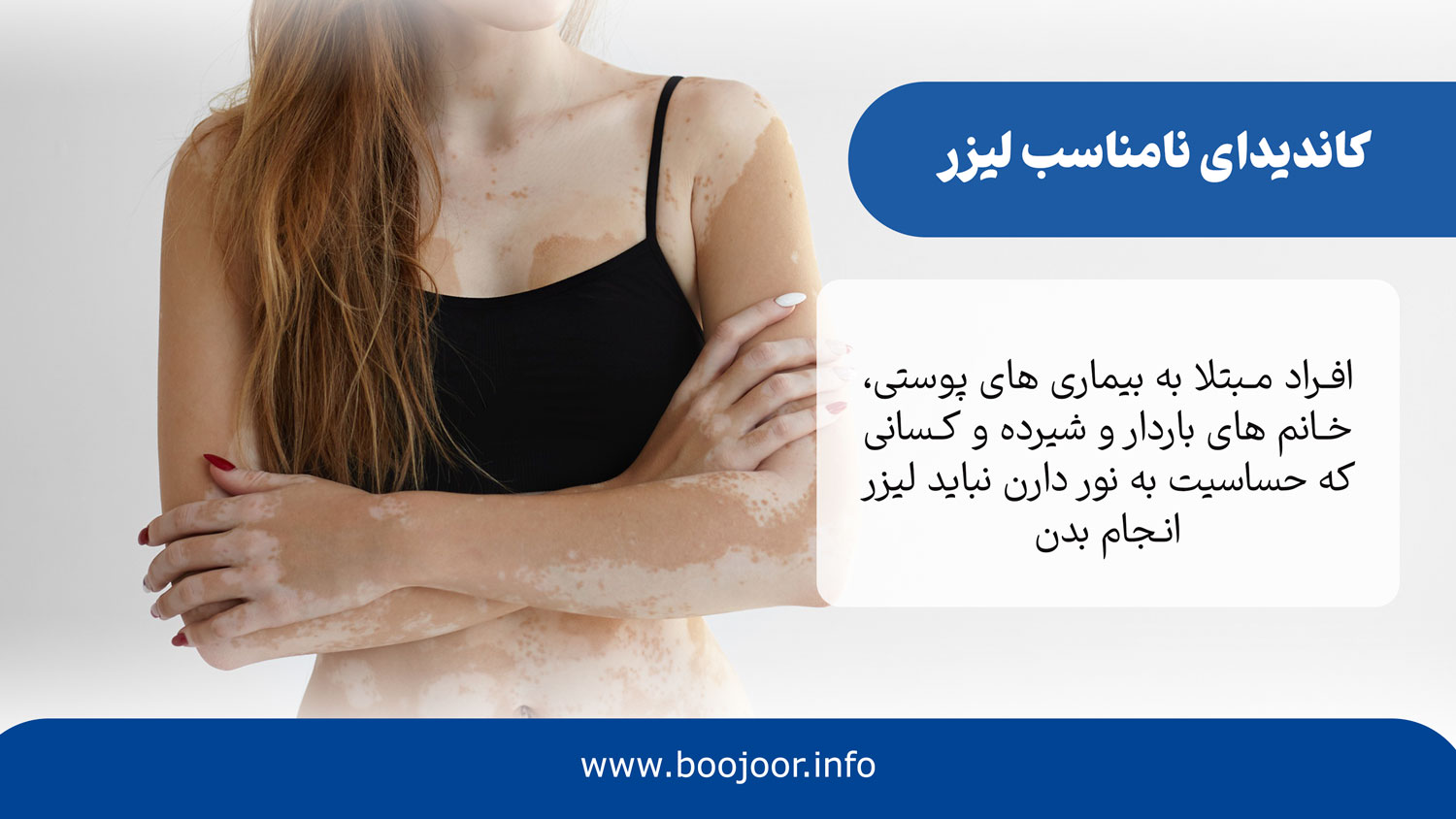کاندیدای نامناسب لیزر