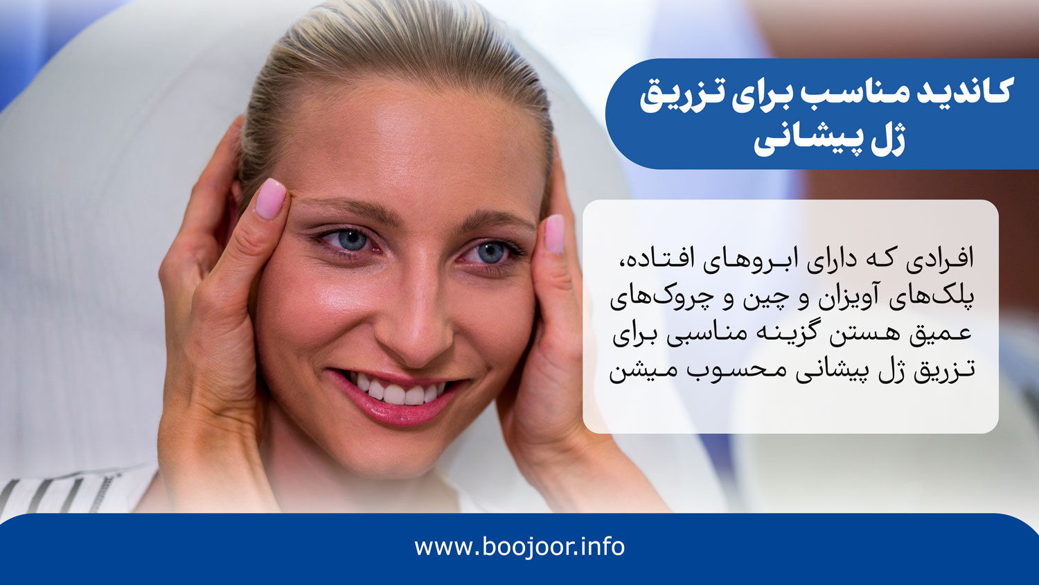کاندید مناسب برای تزریق ژل پیشانی
