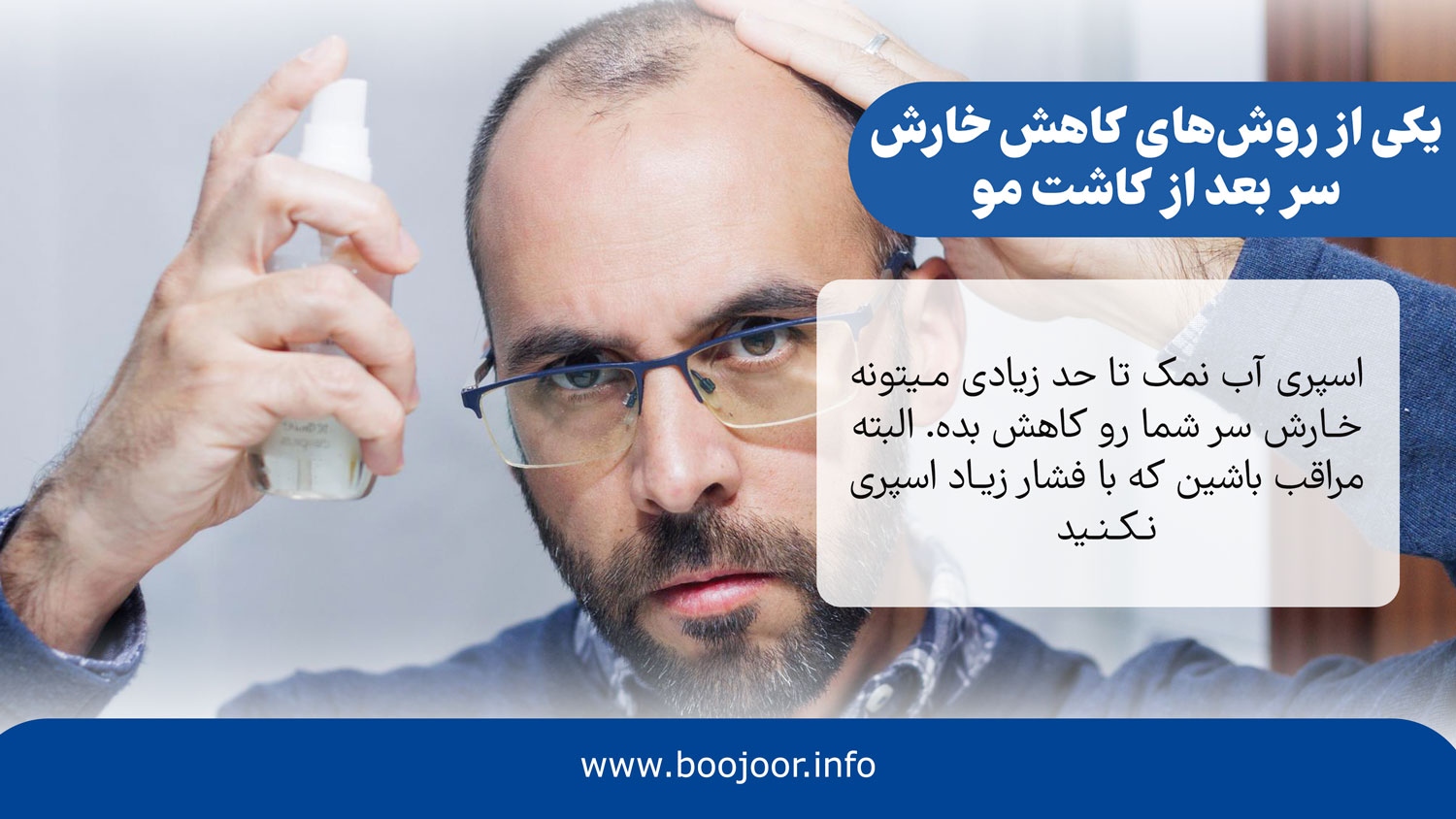 یکی از روشهای خارش سر بعد از کاشت مو