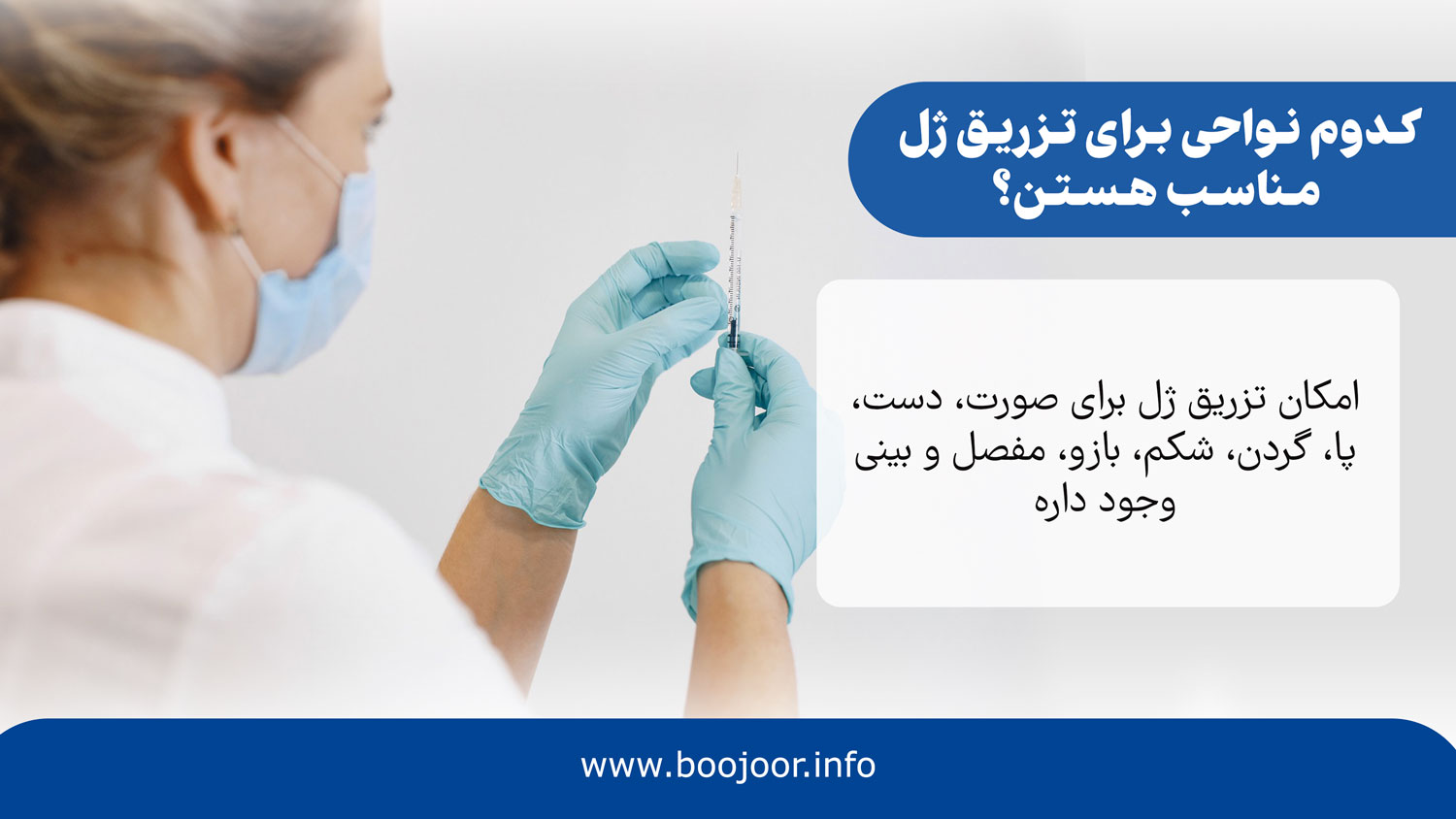 کدوم نواحی برای تزریق ژل مناسب هستن؟