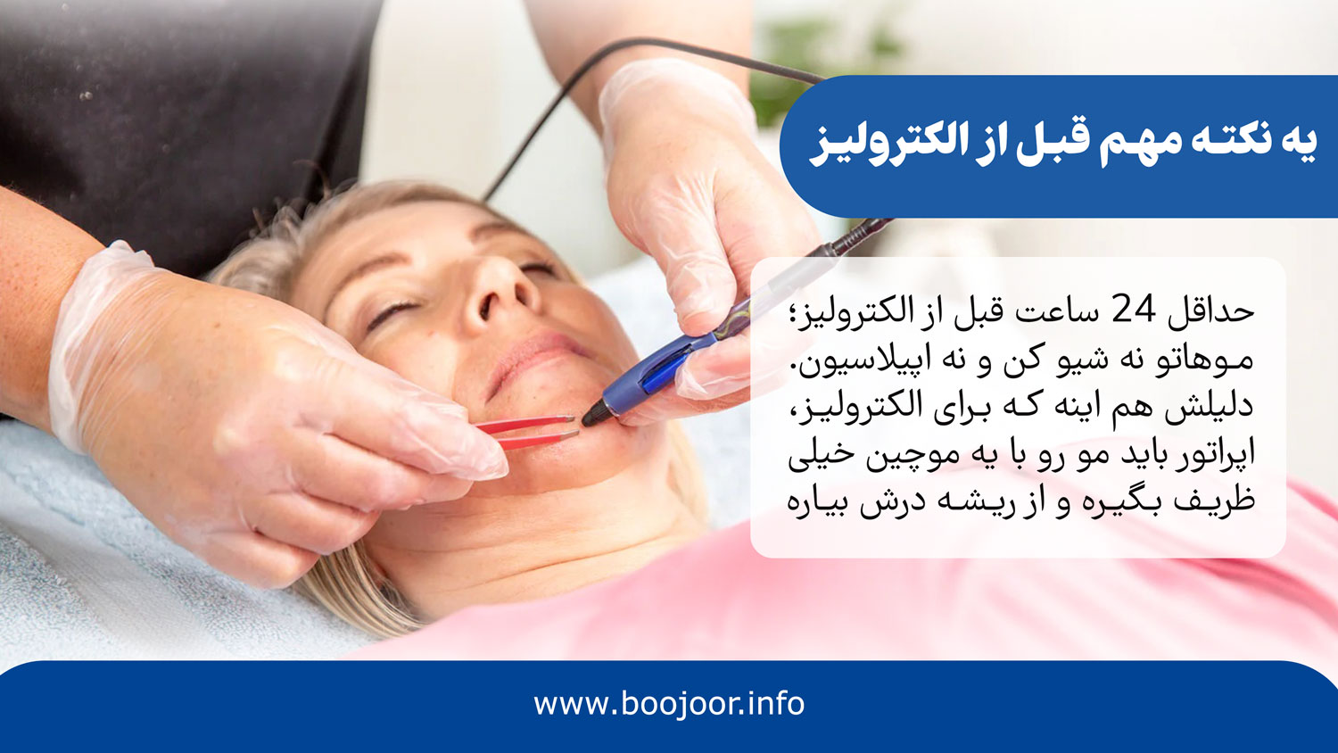 یه نکته مهم قبل از الکترولیز