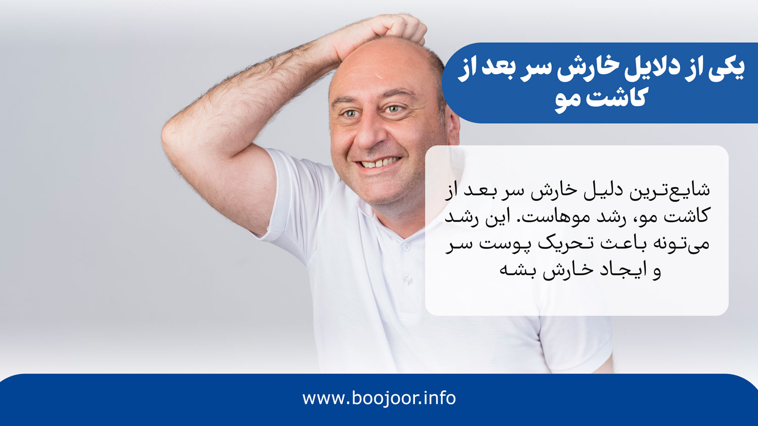 یکی از دلایل خارش سر بعد از کاشت مو
