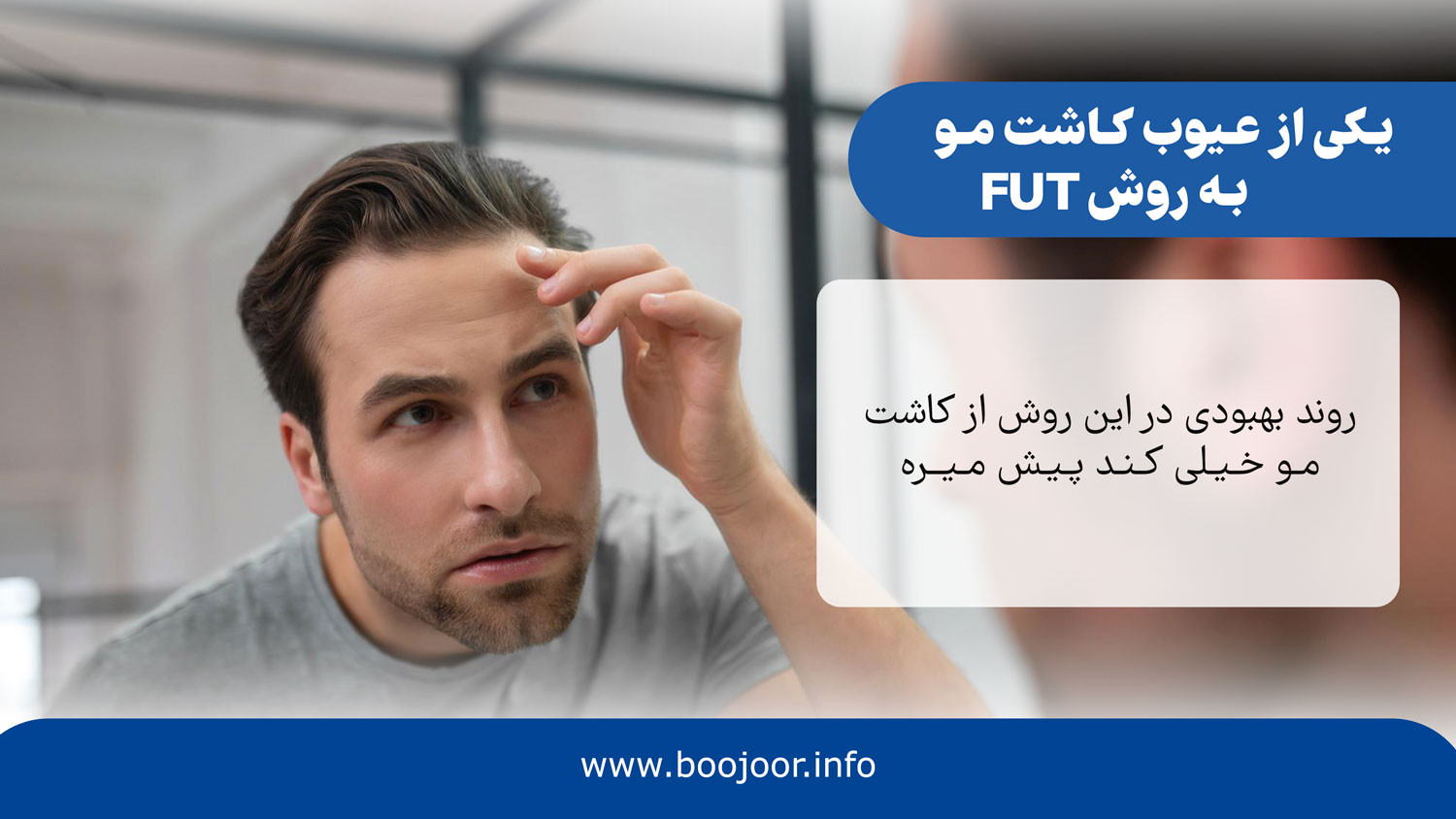 یکی از عیوب کاشت مو به روش fut