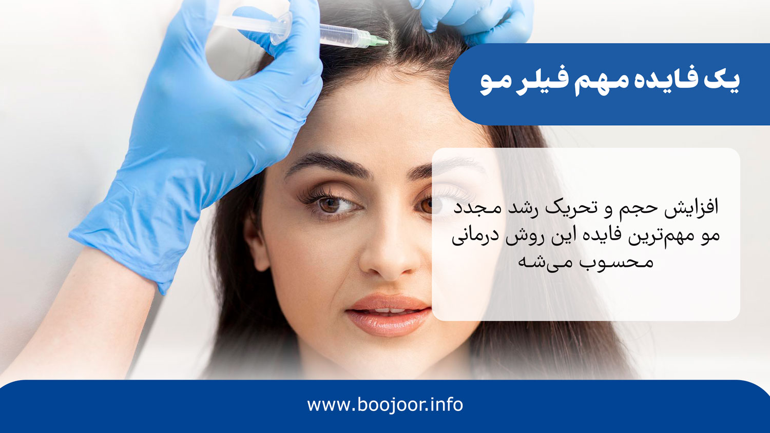 یک فایده مهم فیلر مو