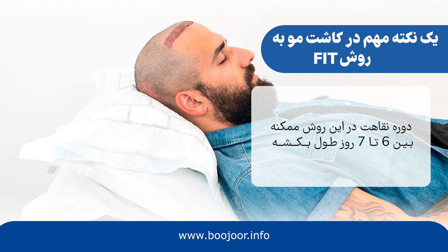 یک نکته مهم در کاشت مو به روش FIT