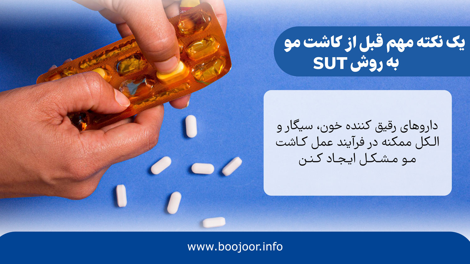 یک نکته مهم قبل از کاشت مو به روش sut